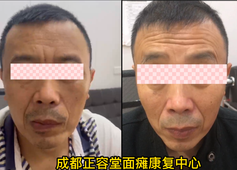 康复病例